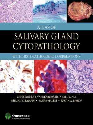 cover image of Atlas of Salivary Gland Cytopathology